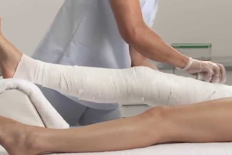 knee-circular-cast-pop-applicati